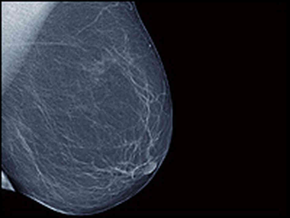 A mammogram. A mammogram.