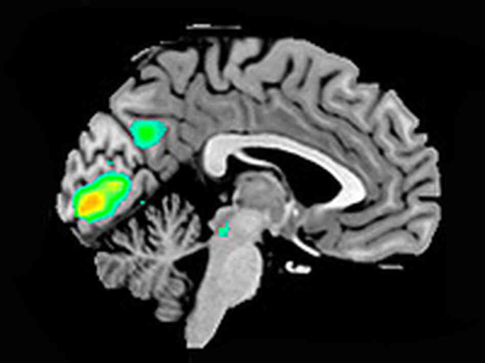 Brain scans of participants thinking about God and religion.