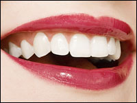 A women with white teeth and red lipstick smiles.
