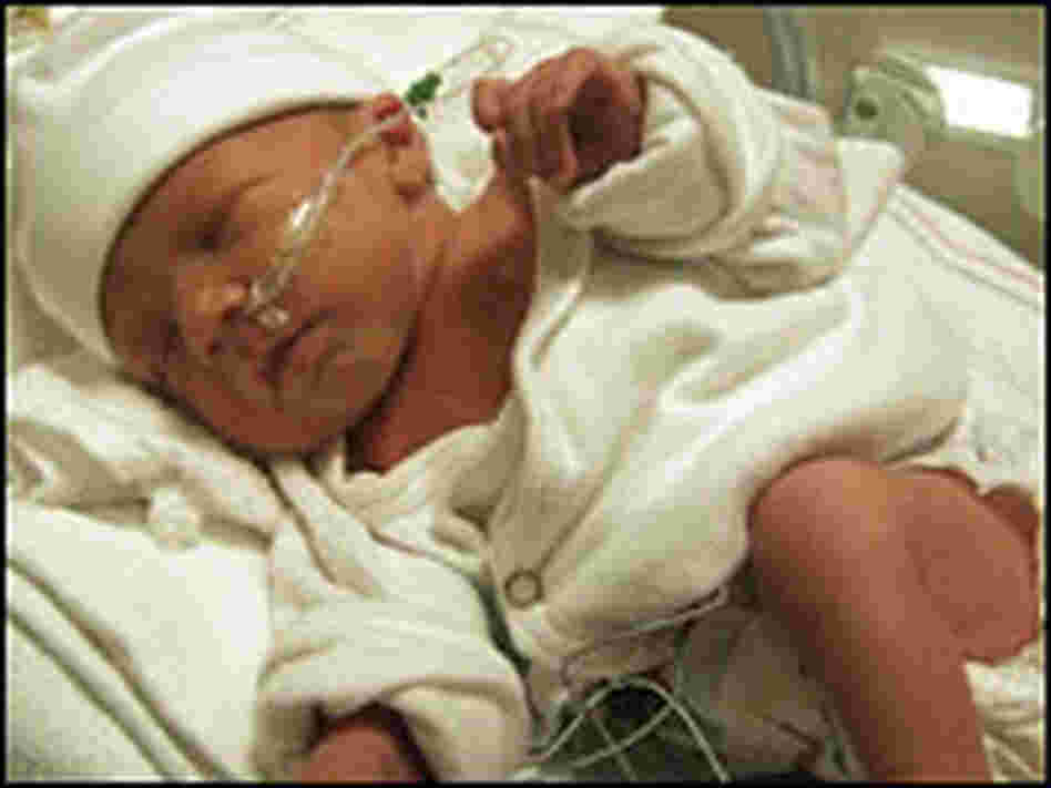 A baby in neonatal intensive care.