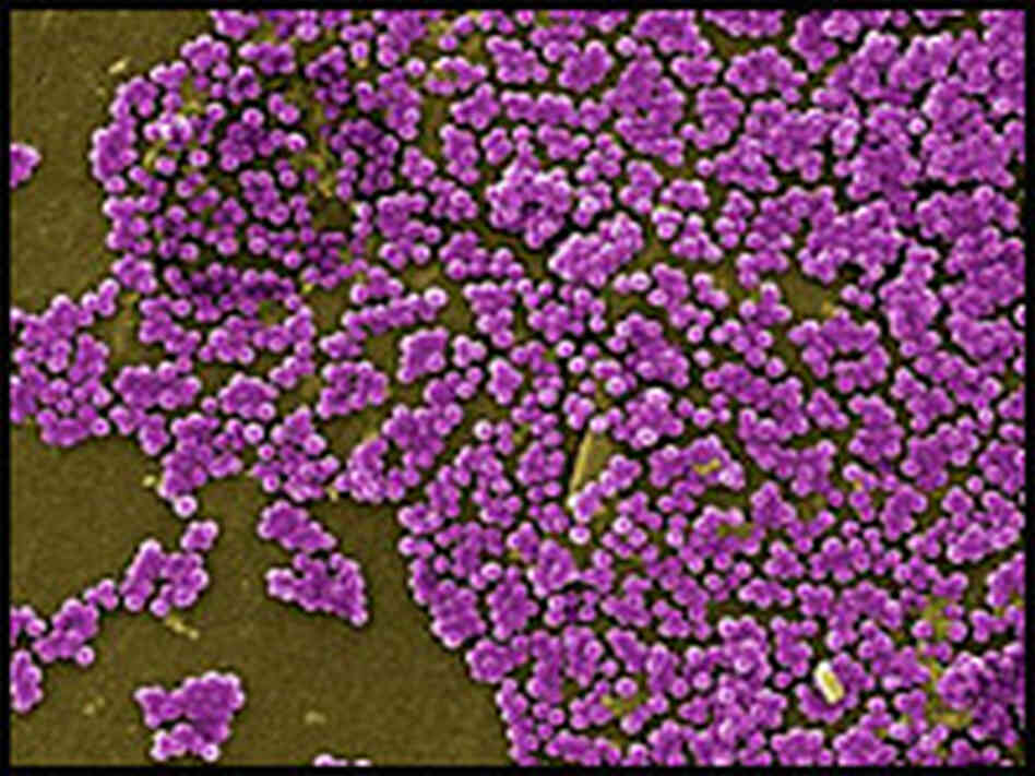 This colorized micrograph shows clumps of the MRSA bacteria. This colorized micrograph shows clumps of the MRSA bacteria.