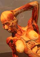Pregnant woman