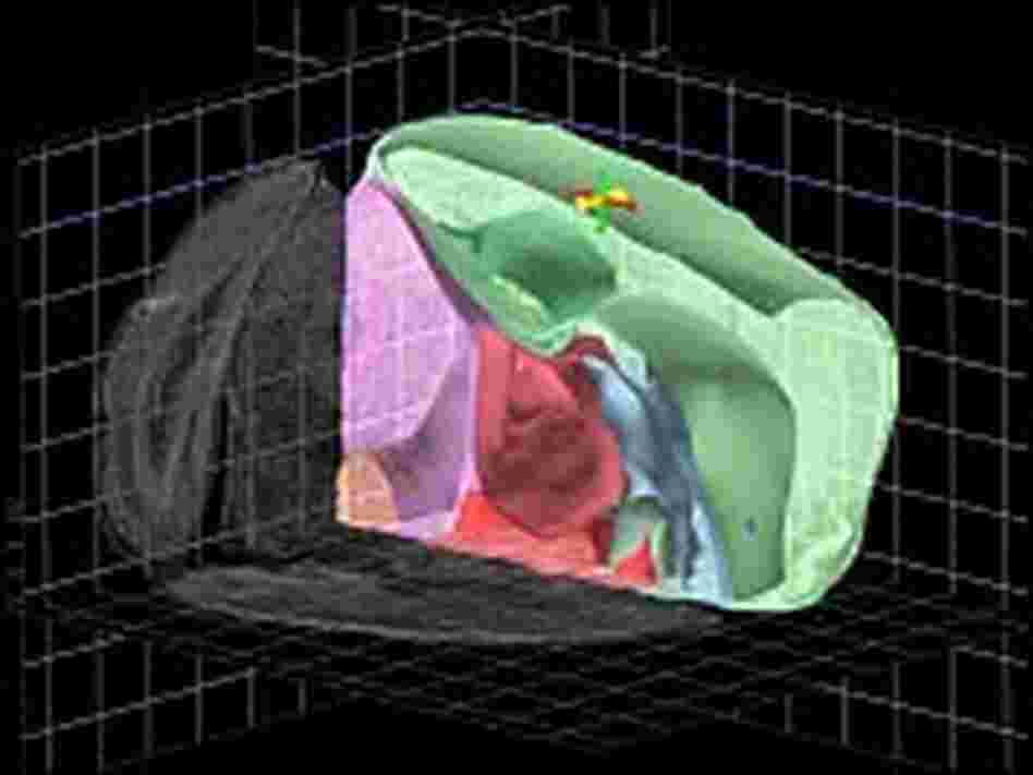 A cut-away view from the Allen Brain Explorer