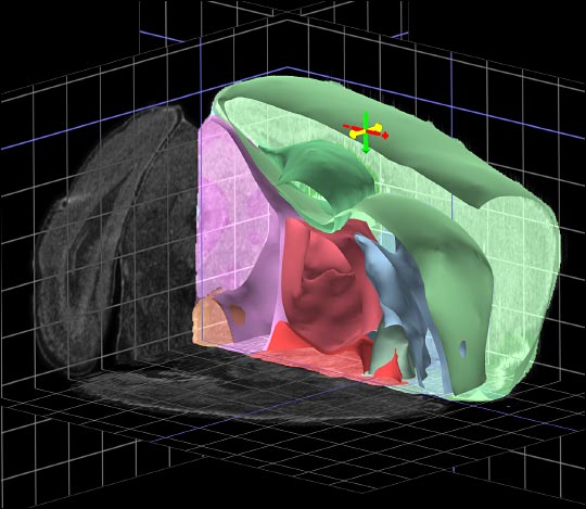 A cut-away view from the Allen Brain Explorer