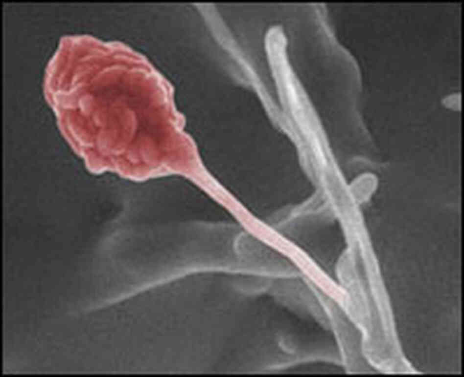 Gliocladium roseum Gliocladium roseum