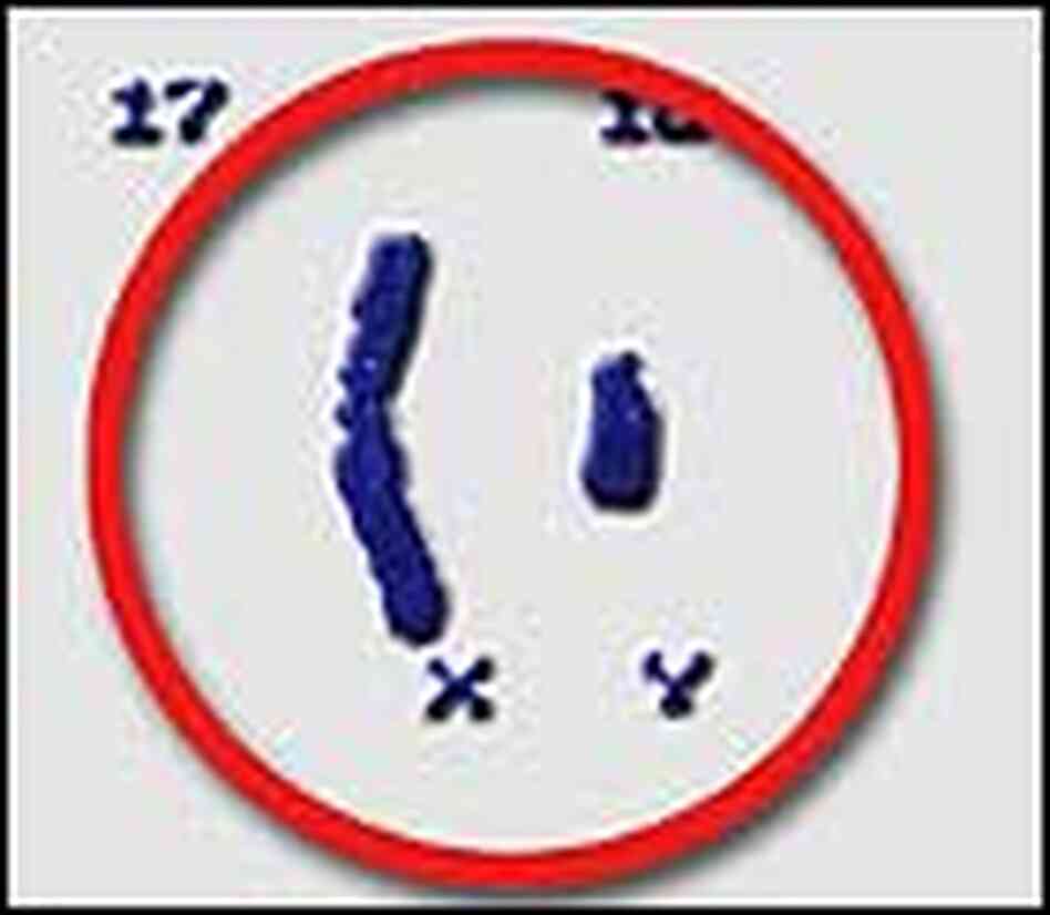X and Y Chromosome X and Y Chromosome