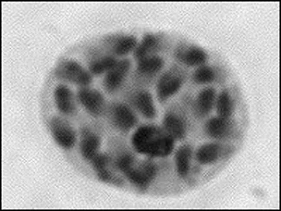 Plasmodia, the parasite that causes malaria, invade a cell. Plasmodia, the parasite that causes malaria, invade a cell.