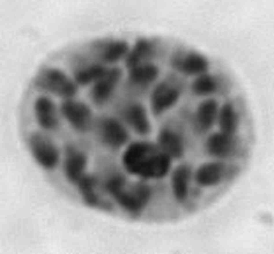 Plasmodia, the parasite that causes malaria, invade a cell. Plasmodia, the parasite that causes malaria, invade a cell.