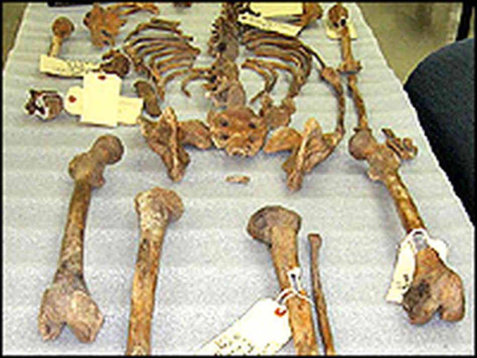 A set of remains under analysis at JPAC, the Joint POW/MIA command in Honolulu. A set of remains under analysis at JPAC, the Joint POW/MIA command in Honolulu.