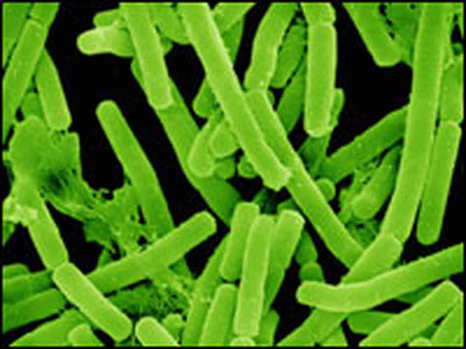 When glands become clogged, a bacterium known as propioni multiplies quickly, leading to acne. When glands become clogged, a bacterium known as propioni multiplies quickly, leading to acne.