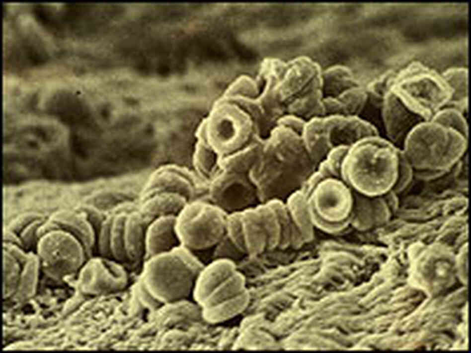 Red blood cells on an artery wall. Red blood cells on an artery wall.