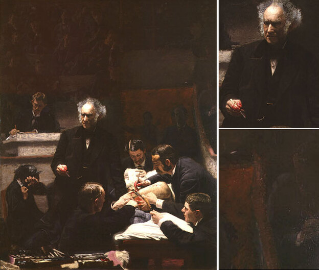 'The Gross Clinic'