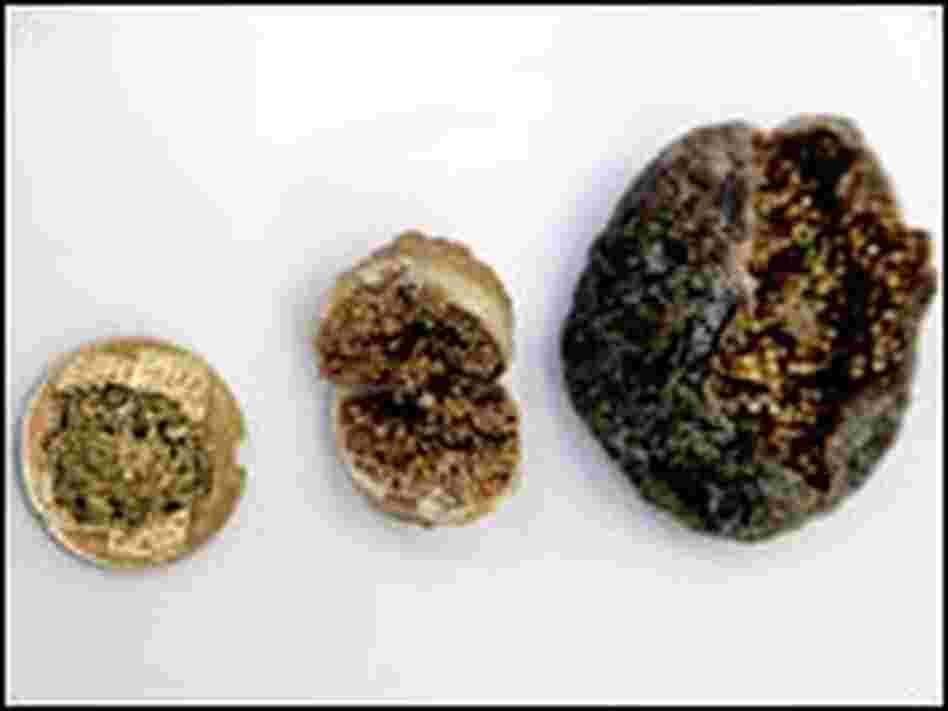 Figs