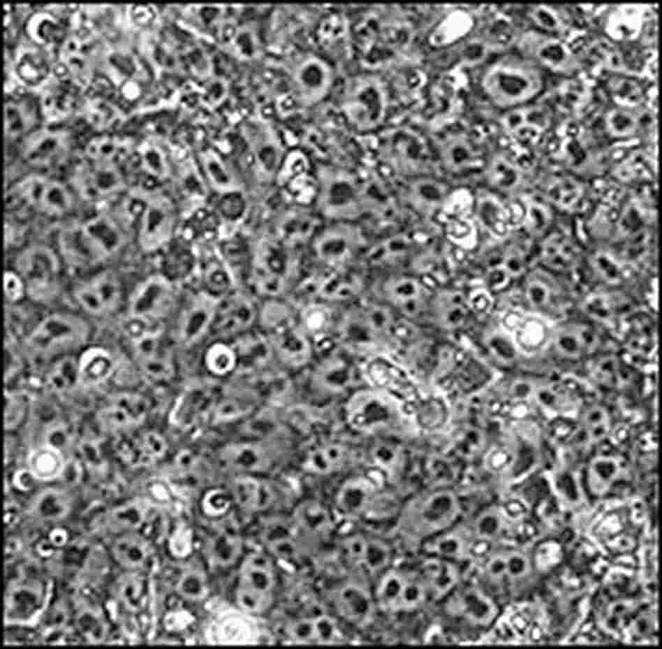 A colony of embryonic stem cells. A colony of embryonic stem cells.