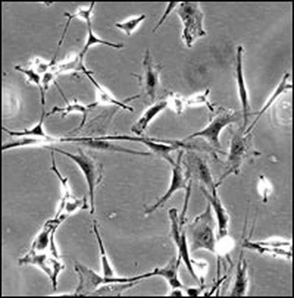 Neural stem cells