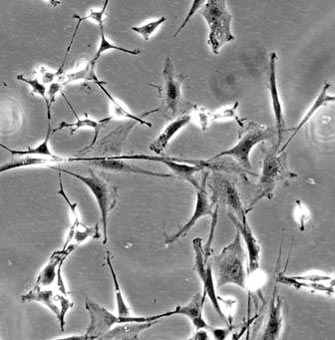 Neural stem cells
