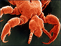 Close-up of human head louse.