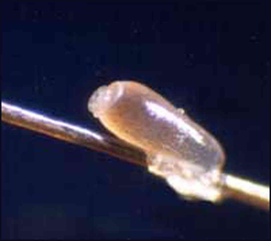 A louse egg on a hair strand. A louse egg on a hair strand.