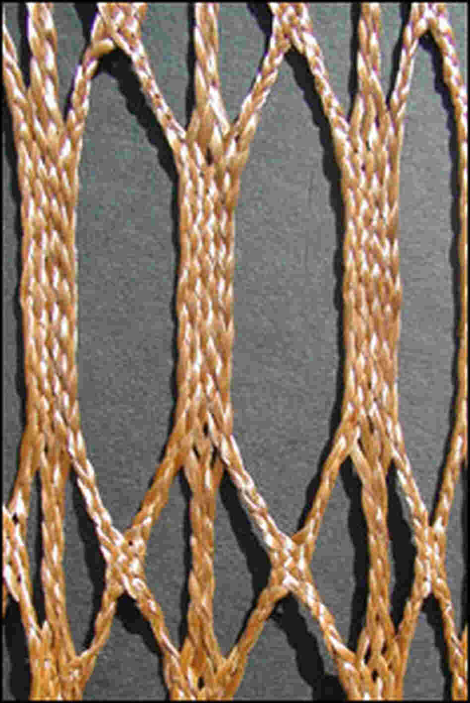 A detail of a braided tether.  Gold strings intricately interwoven.