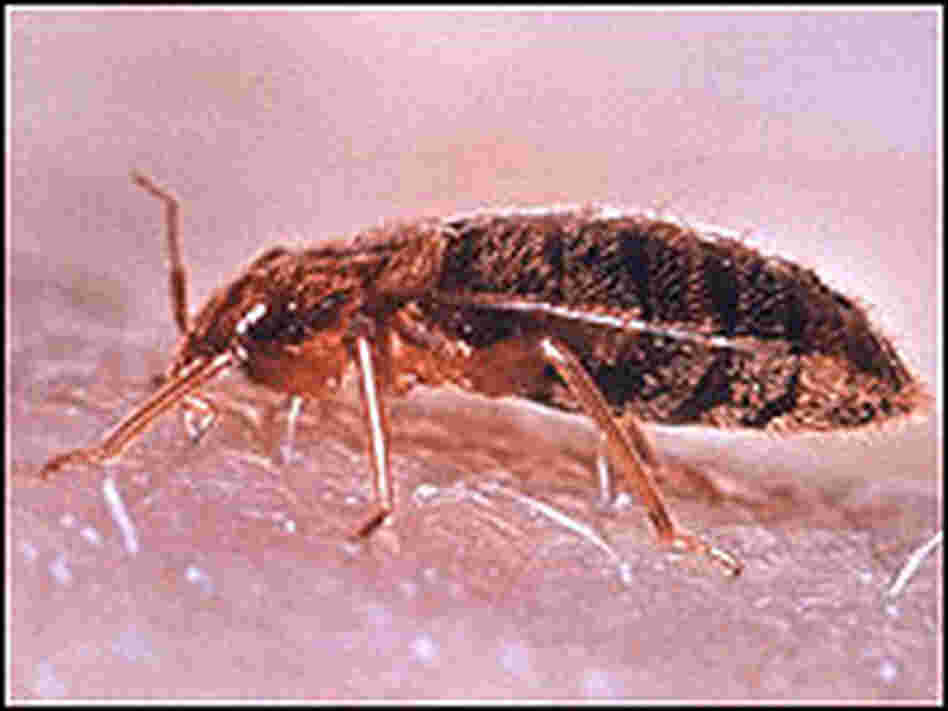 Bedbug on human skin.
