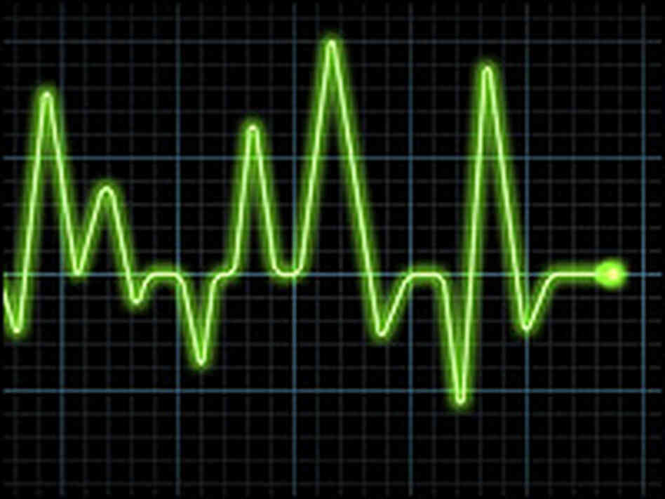 An electrocardiogram, or graphical reading of the heart's electrical activity. An electrocardiogram, or graphical reading of the heart's electrical activity.