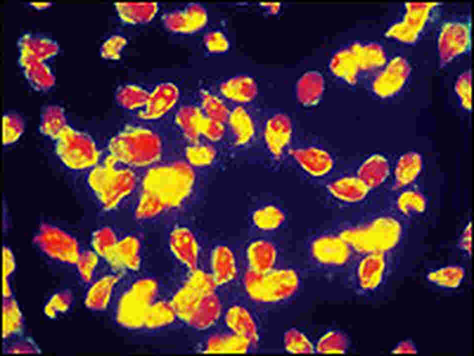 A microscopic view of Giardia.