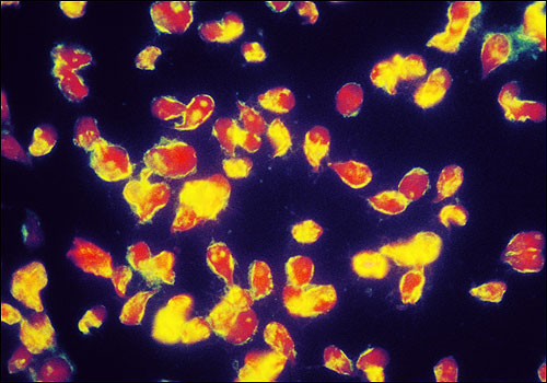 A microscopic view of Giardia.