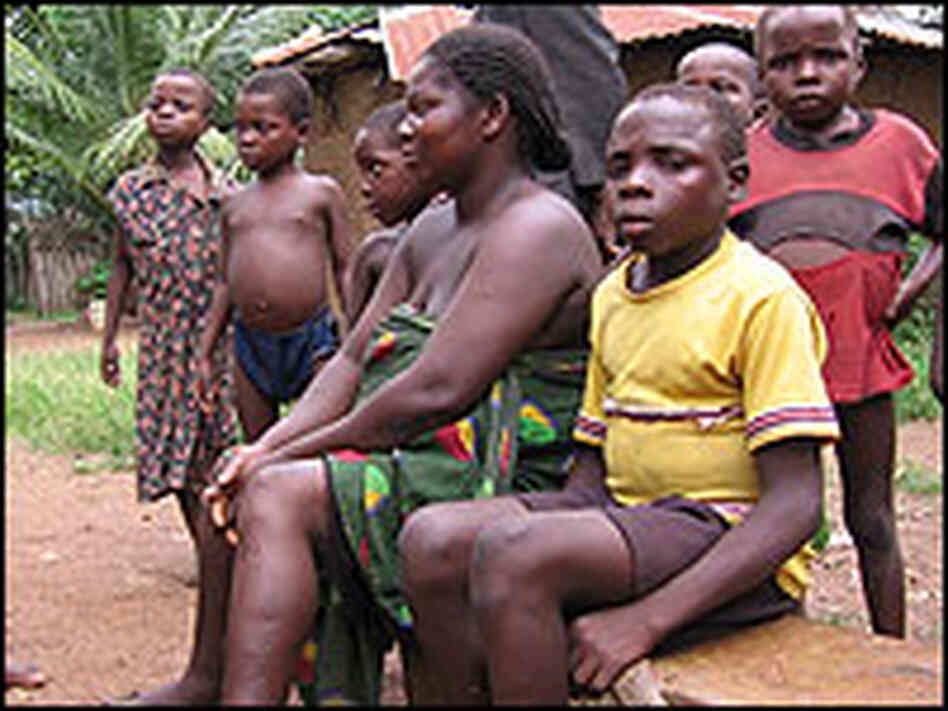 Monday Mweke, age 9, seen here with his mother,