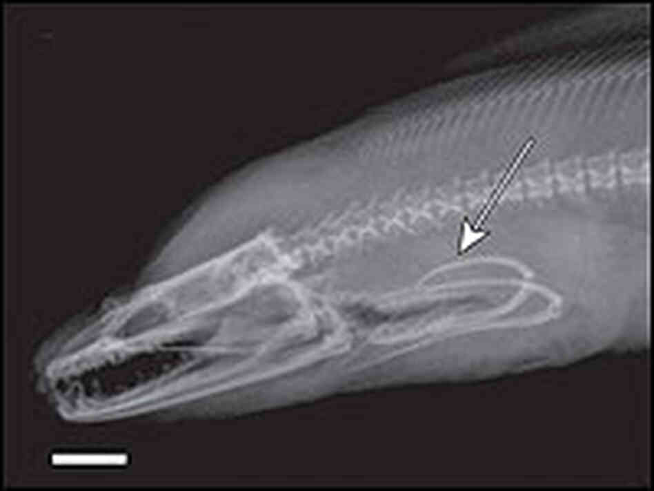 Eel x-ray.