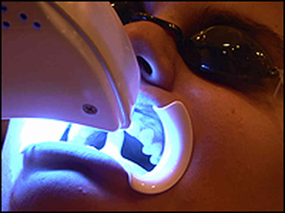 A patient undergoes a light-activated bleaching process. A patient undergoes a light-activated bleaching process.
