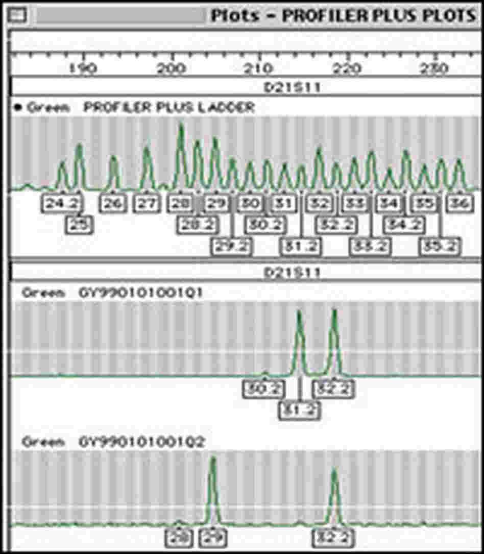 Genetic code in FBI database.