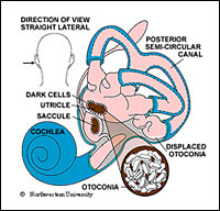 Ear rocks are small crystals of calcium carbonate called