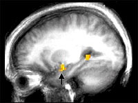 Scans of the human brain show regions of activity as certain types of memories are recalled.