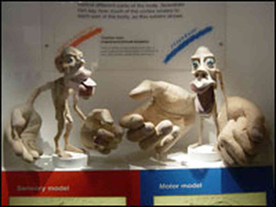 A 'Homunculus Man'