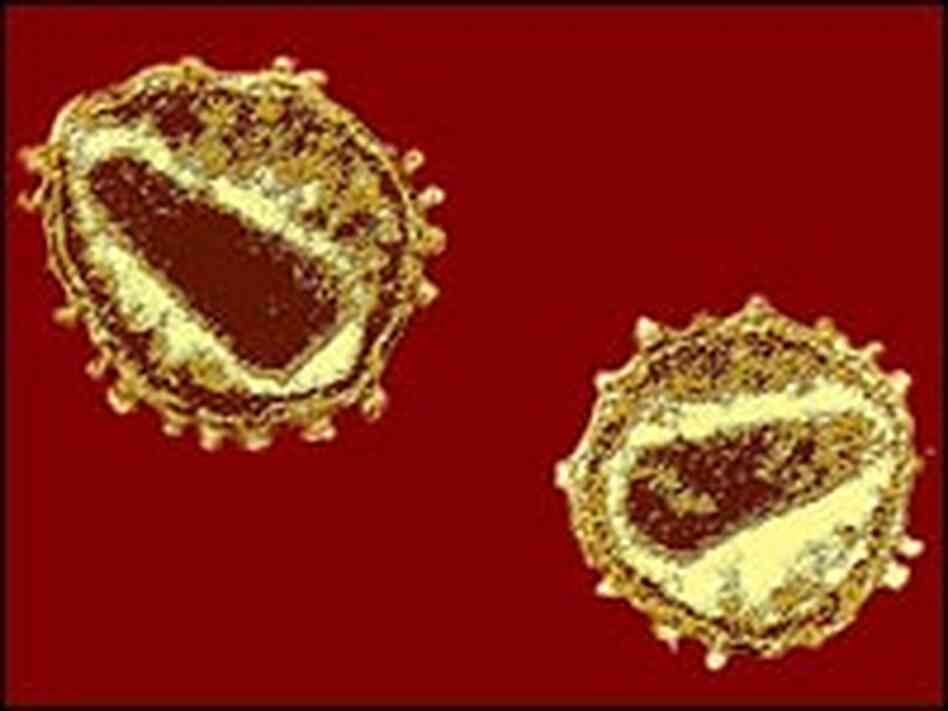Human Immunodeficiency Virus Human Immunodeficiency Virus