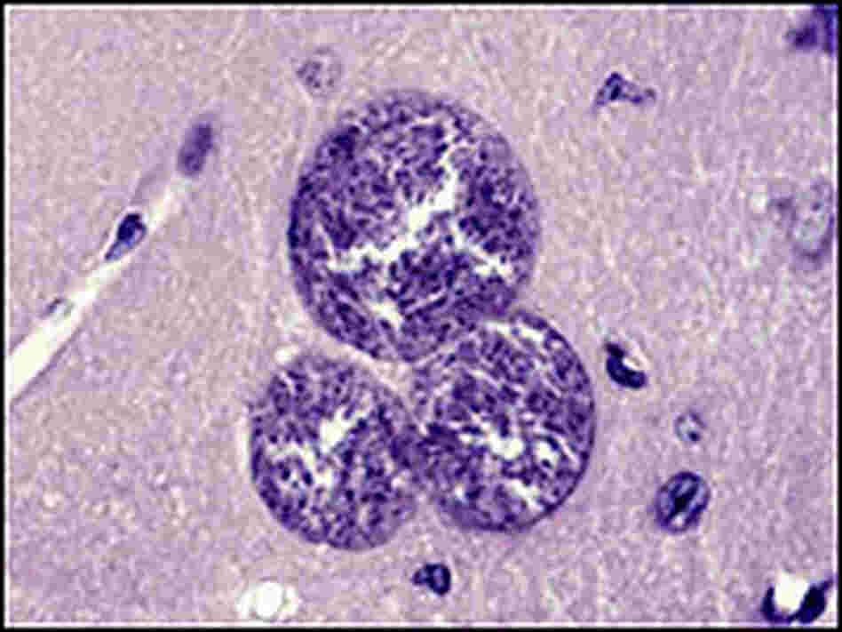 Toxoplasma gondii cysts in a mouse brain Toxoplasma gondii cysts in a mouse brain