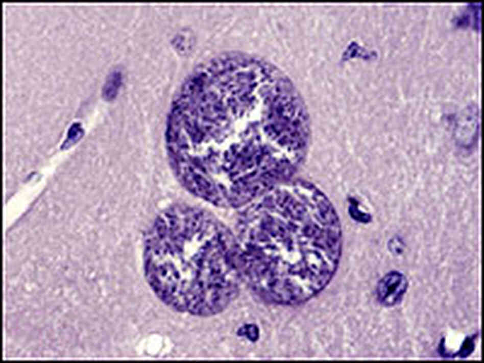 Toxoplasma gondii cysts in a mouse brain Toxoplasma gondii cysts in a mouse brain