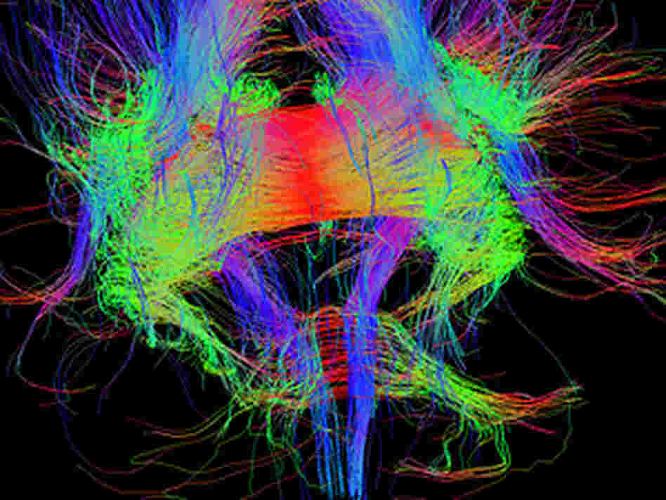 Brain image Brain image