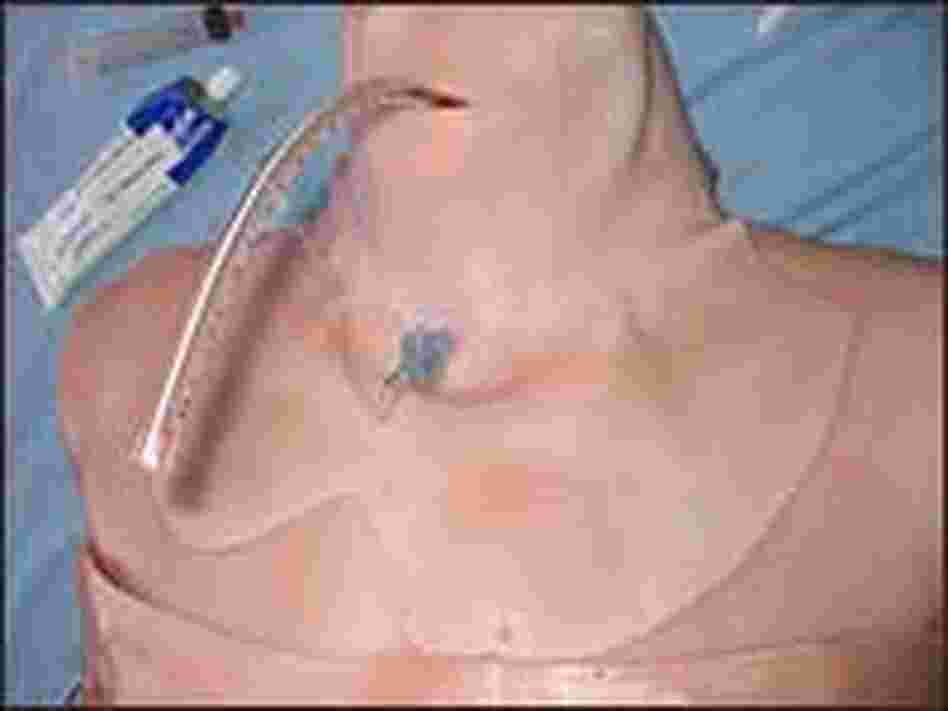 The Trauma Man's torso.