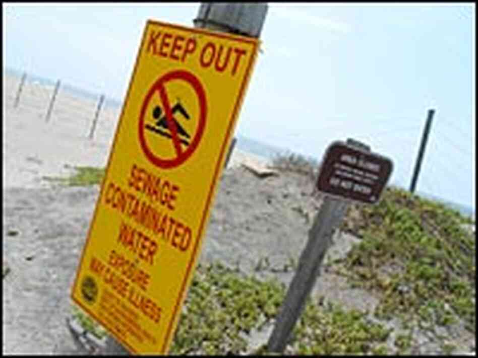 Signs on the U.S. side of the border warn against sewage contamination in the ocean. Signs on the U.S. side of the border warn against sewage contamination in the ocean.