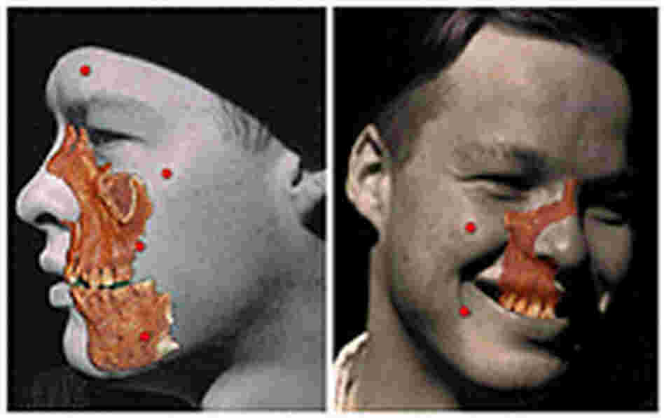Skull fragments superimposed over Ruess' portraits. National Geographic Adventure