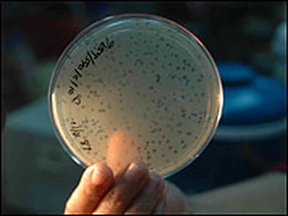 Clear spots on the petri dish mark where phages have destroyed bacteria in Ganges water.