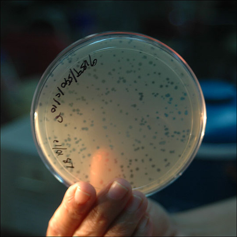 Clear spots on the petri dish mark where phages have destroyed bacteria in Ganges water.