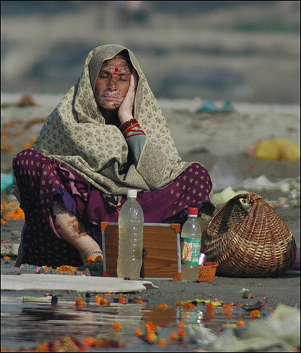 A woman with a skin disease rests near offerings and trash on the banks of the Ganges.