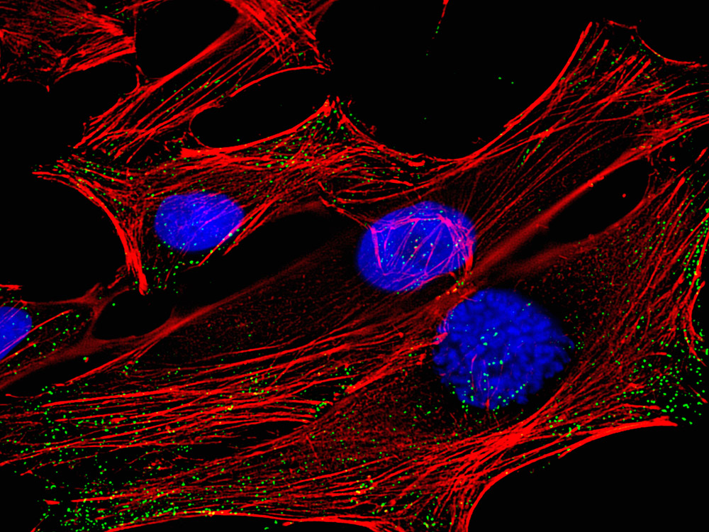 A fluorescence micrograph of HeLa cells, derived from cervical cancer cells taken from Henrietta Lacks and named in her honor (Getty Images)