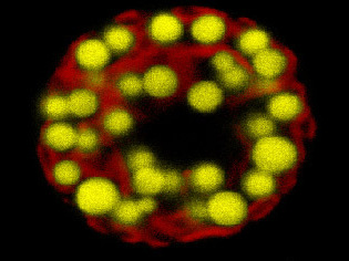 When you deprive Chlamy of nitrogen, it bloats up with triacylglycerides (TAGs) until it looks like a fat-guy cartoon. Here, the red is chlorophyll fluorescence and the yellow comes from a dye that fluoresces yellow when it’s embedded in TAGs. (NPR)