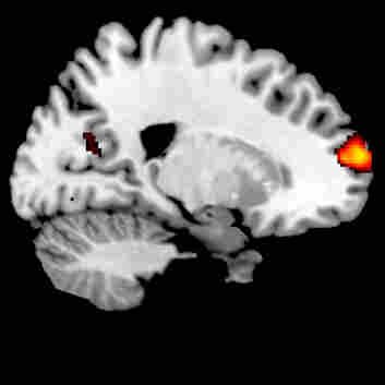 Brain scans Brain scans