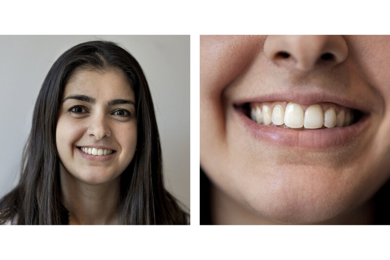 Braces For Young Kids Might Not Always Be Best NPR