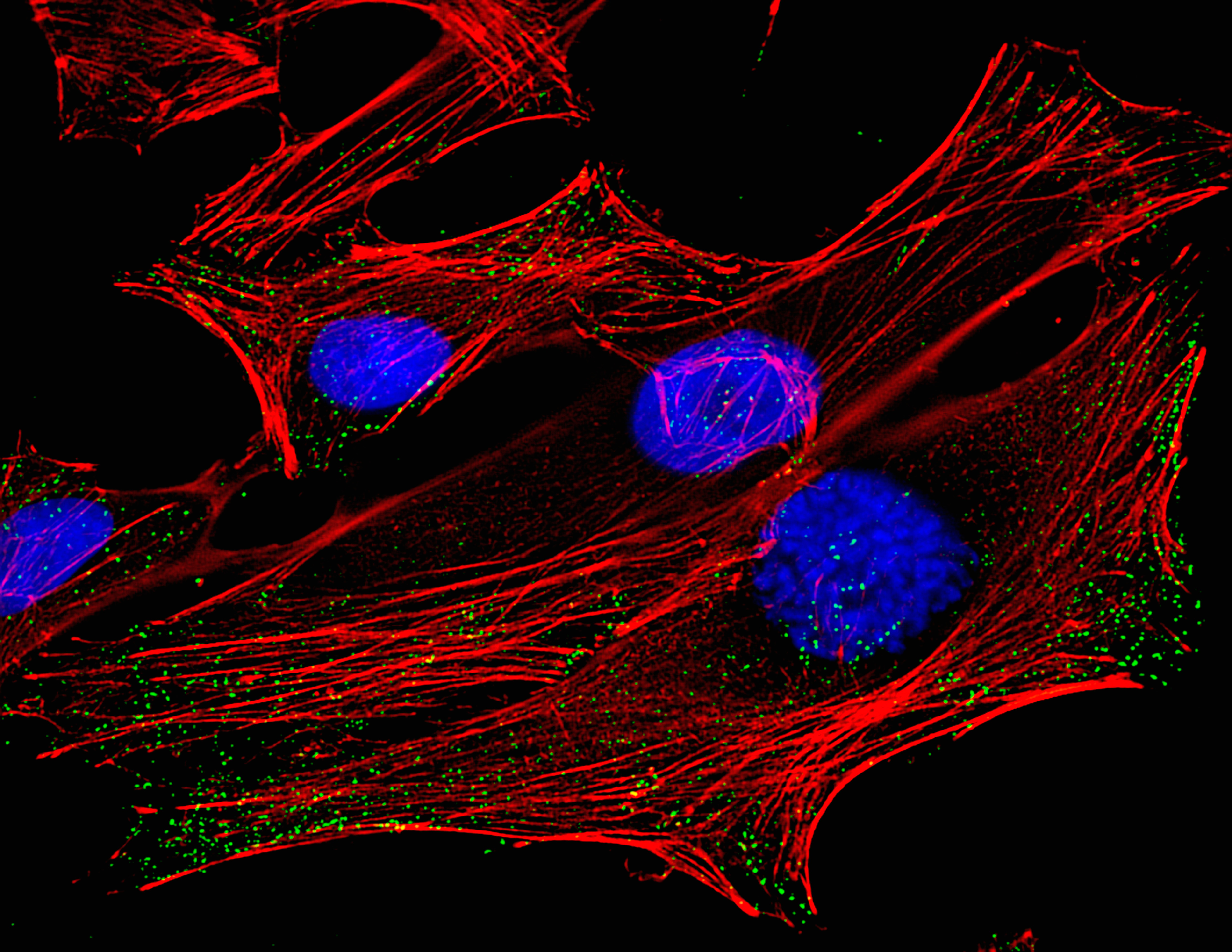 A fluorescence micrograph of HeLa cells, derived from cervical cancer cells taken from Henrietta Lacks and named in her honor (Getty Images)
