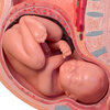 Babies' Developing Brains Fed By Placenta, Not Mom